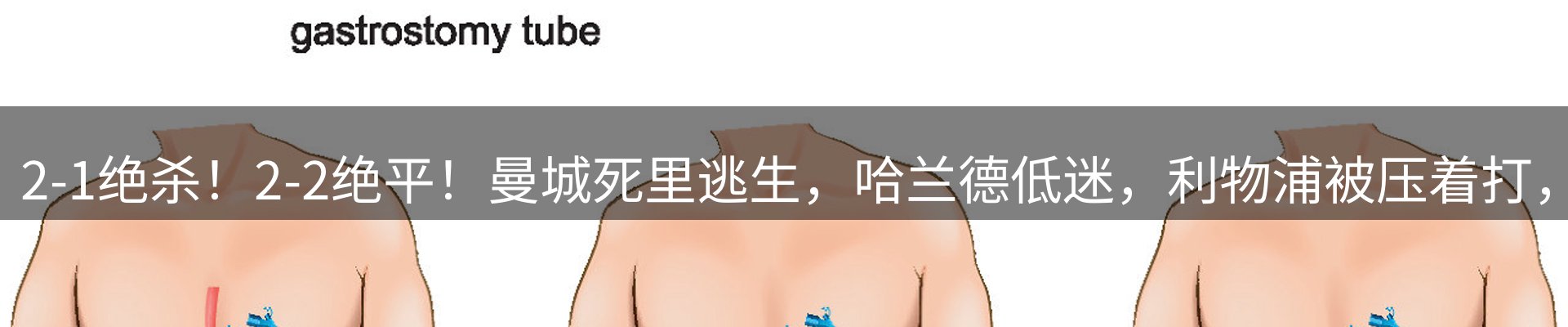 热点聚焦